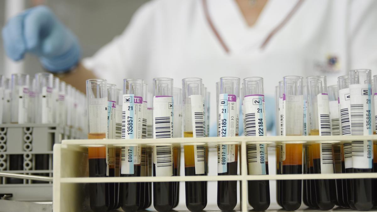 Prueban otro nuevo método para diagnosticar el alzhéimer con un análisis de sangre